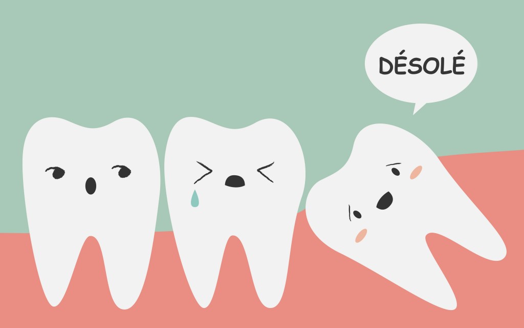 Tous les symptômes des dents de sagesse